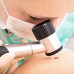 consulter un dermatologue ?